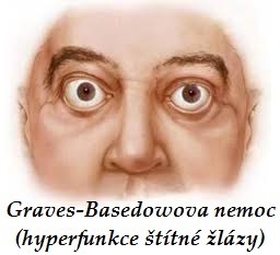 basedowova nemoc zvysena funkce stitne zlazy byliny bylinky babske rady