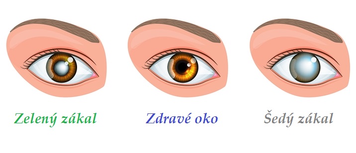 Šedý zákal zelený zákal byliny bylinky léčba babské rady lidové léčitelství