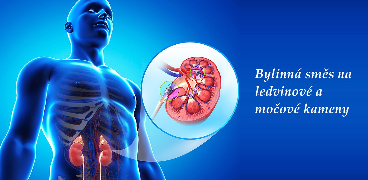 Bylinná směs na ledvinové a močové kameny nebo písek