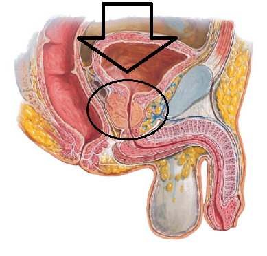 Zvětšená prostata, zánět prostaty - byliny, bylinky, babské rady, obklady, čaje